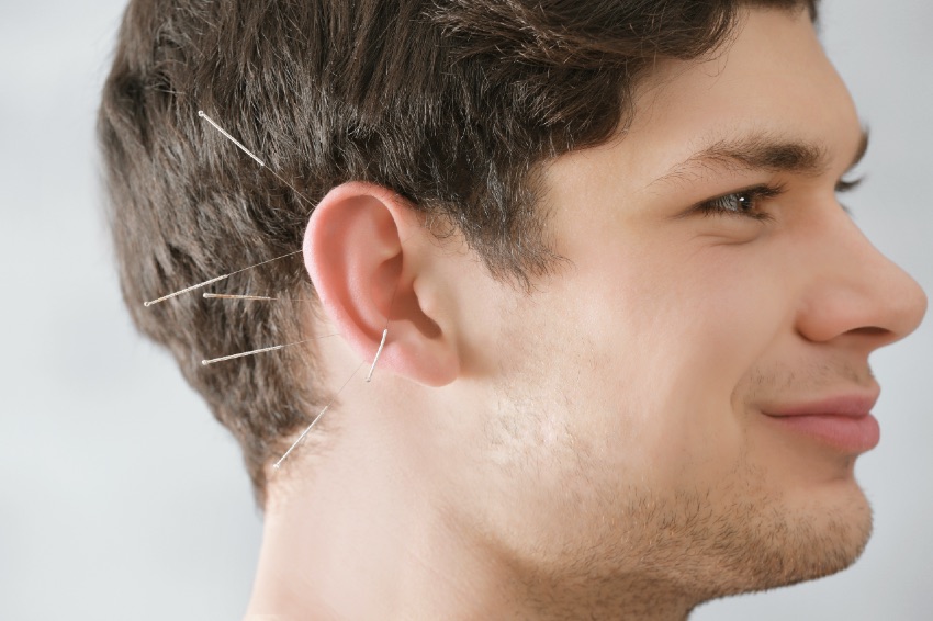 akupunktur mand øre